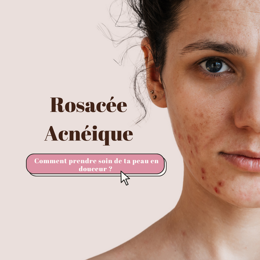 Comment prendre soin de ta peau en douceur ?