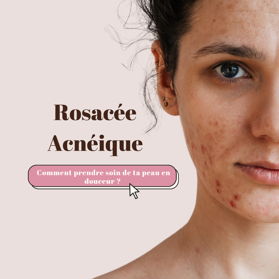  Comment prendre soin de ta peau en douceur ?